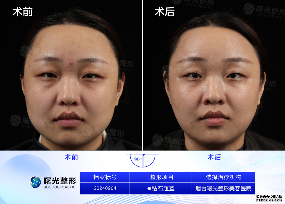 钻石超塑.jpg
