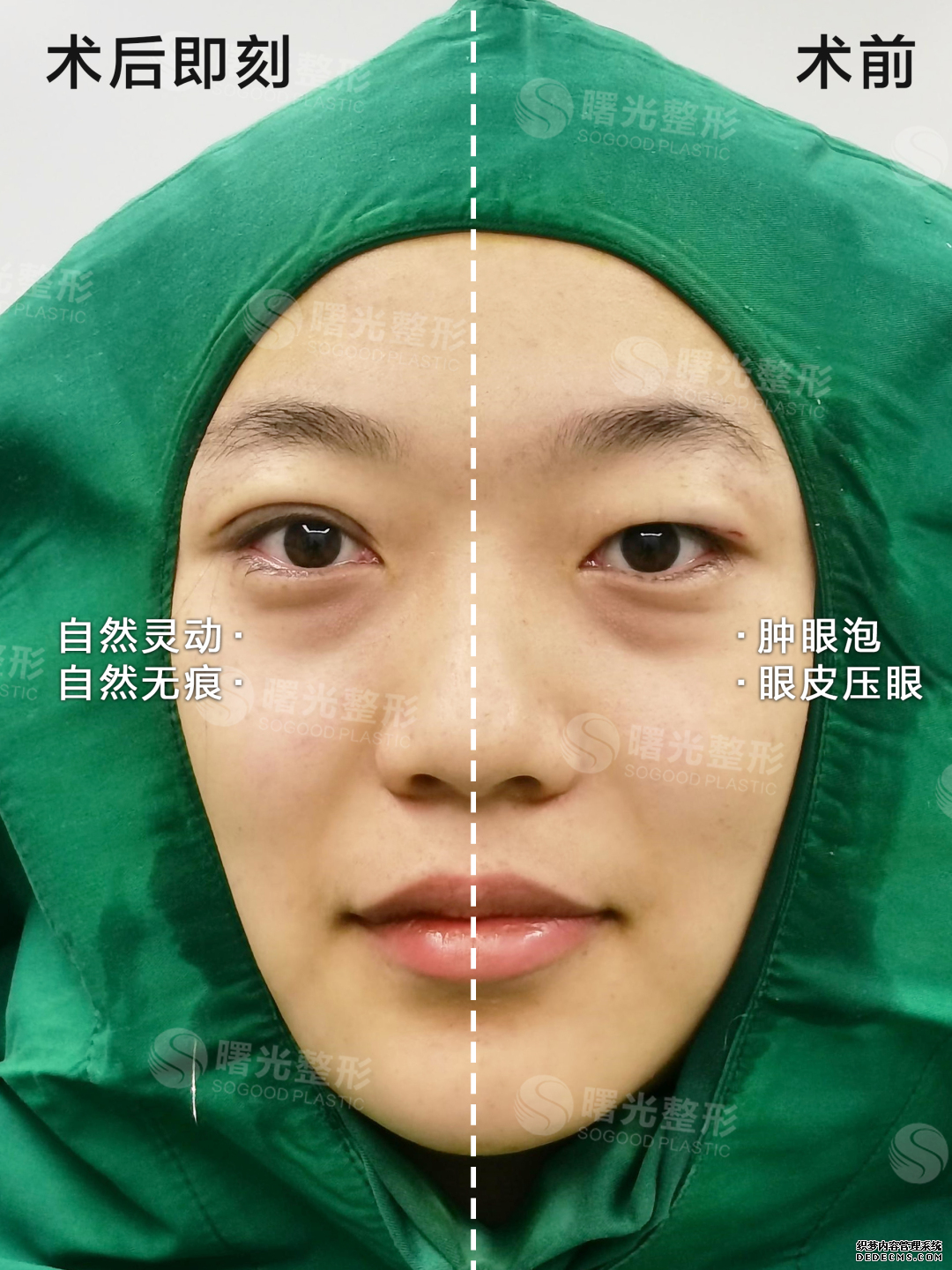 9.2 对比图钻石星星眼.jpg